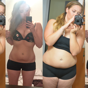 Weight Loss Before and After